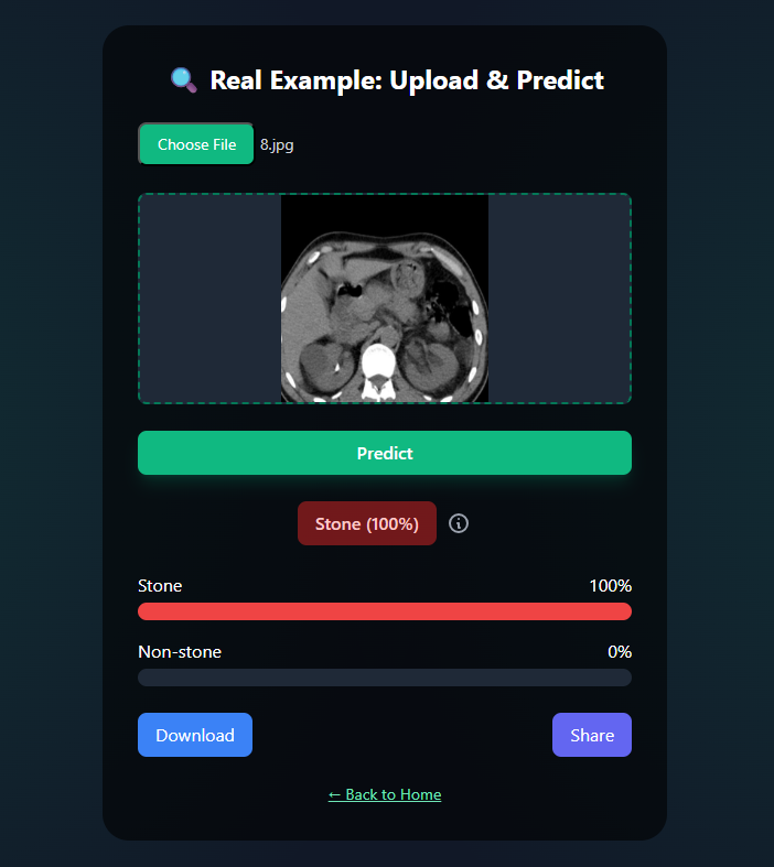 Result UI